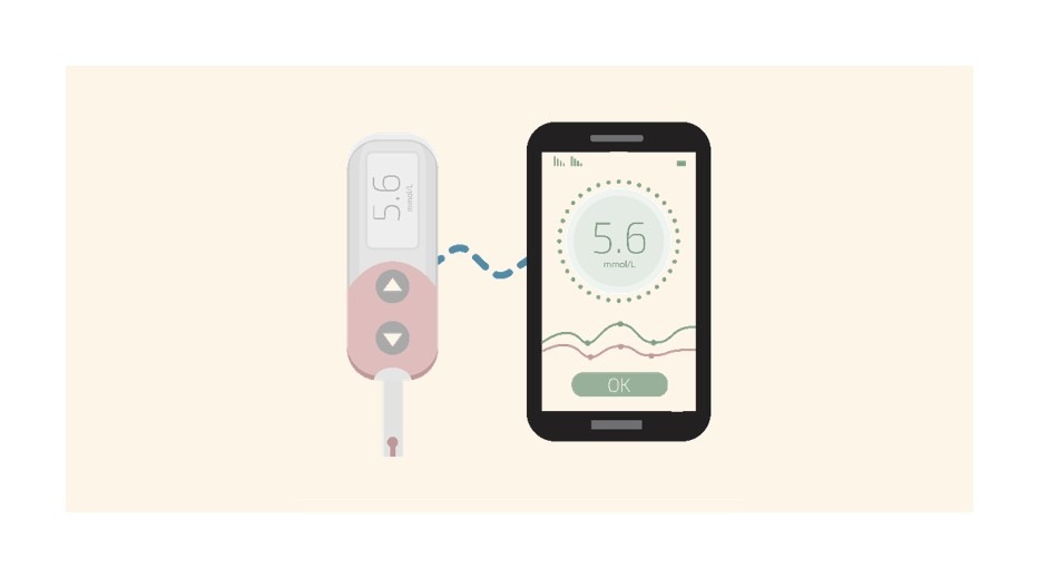 The Future of Diabetes Care Key Innovations in the Continuous Glucose Monitoring by EOS Intelligence