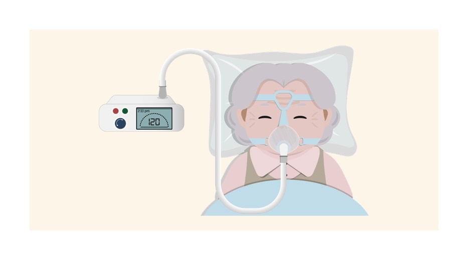 Recall Aftermath: Who is Gaining Share in the Sleep Apnea Devices and Ventilators Market?